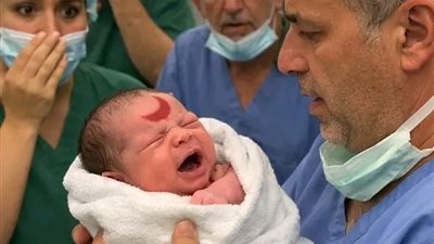 امرأة في غيبوبة منذ أربع سنوات